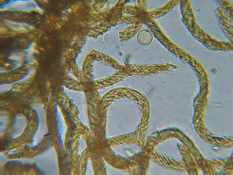 Ma non spariscono mai ?